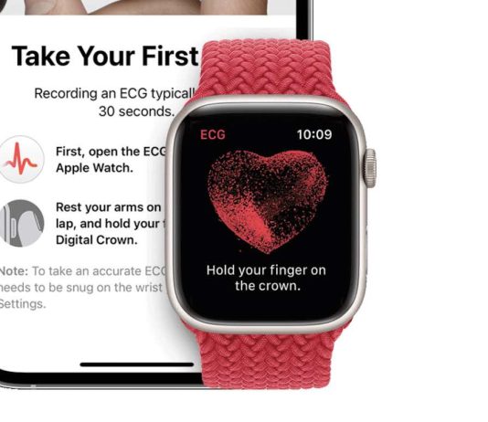 Apple Watch Afib History feature