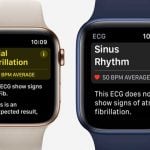EGG app classification following taking an ECG on Apple watch