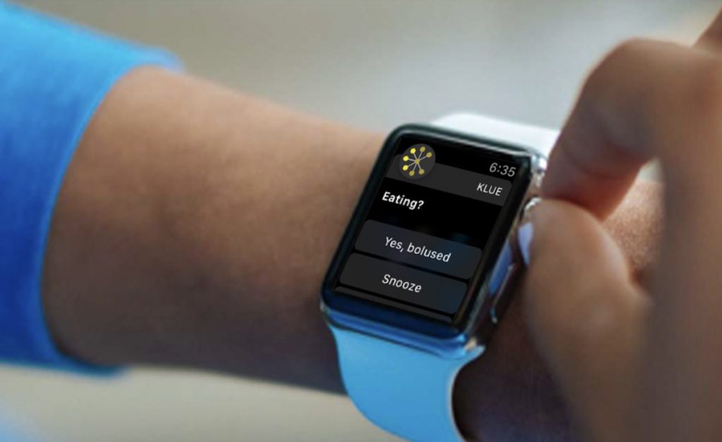 Apple Watch Gesture detection to power Type1 Diabetes