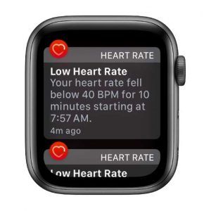 Apple Watch able to detect arrhythmias other than AFib ( new findings