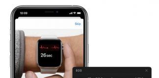 Apple Watch updates to ECG app