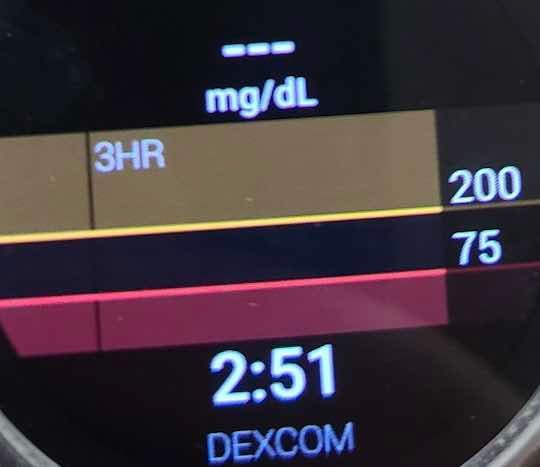 Dexcom readings missing on wearOS Smartwatch