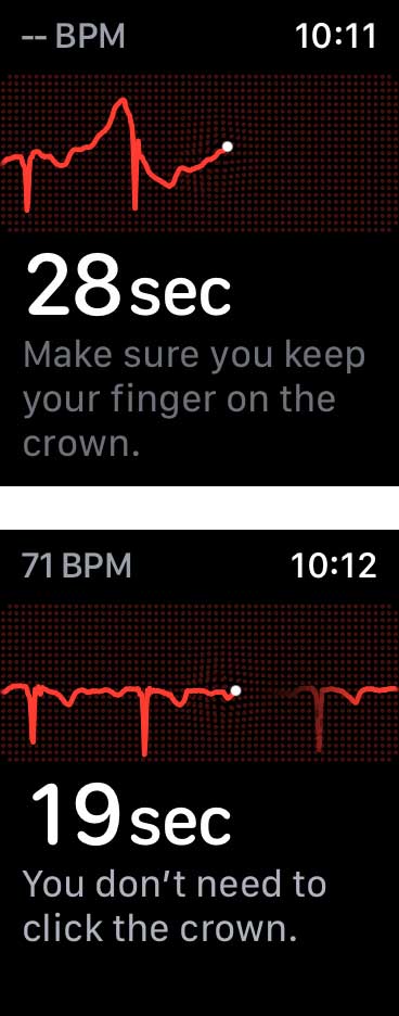 Using the Digital Crown to take an ECG on Apple Watch