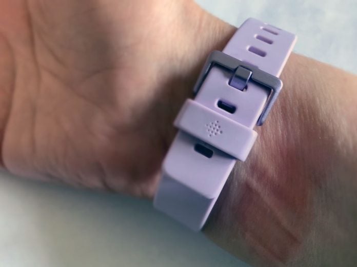 Fitbit Inspire HR band irritation and rash