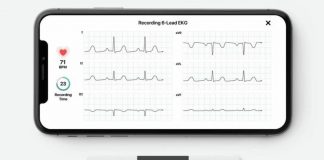 Kardiamobile 6L EKG