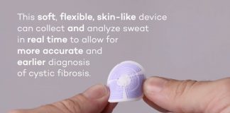Sweat sensor wearable for cystic fibrosis