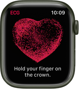 apple watch ecg